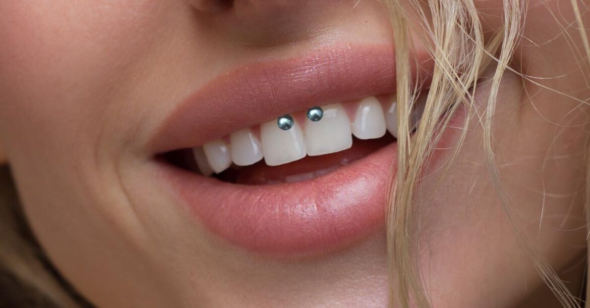 Smiley Piercing